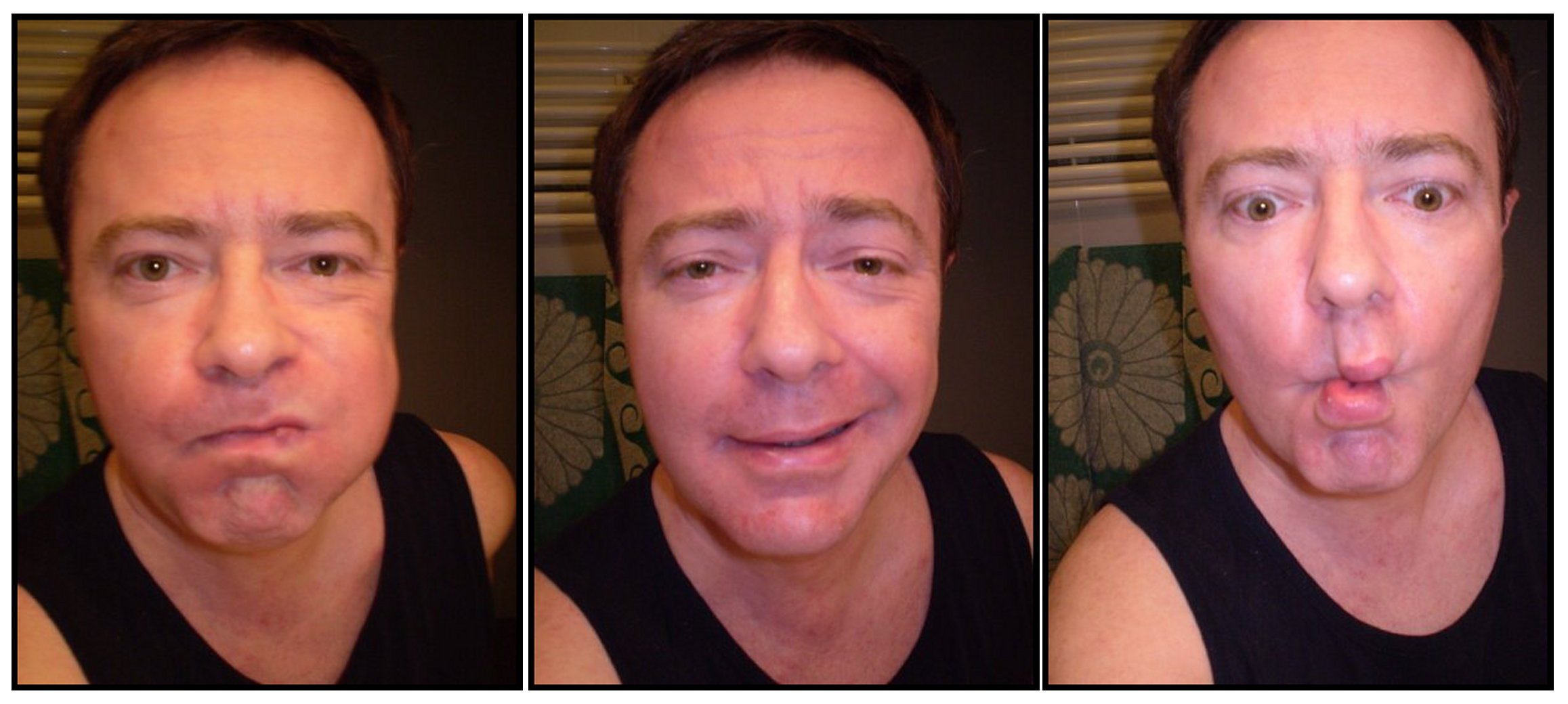 Profilo di Pierre-anthony